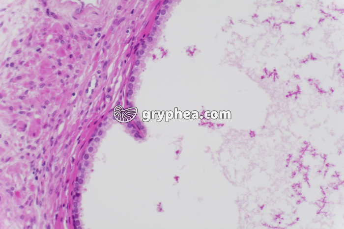 Prostate x100 - gryphea.com